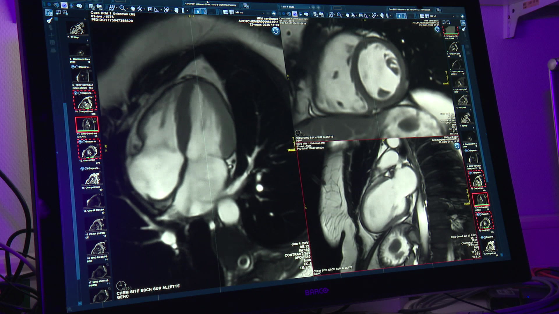 Highest standards guaranteed: CHEM recognised as reference centre for cardiac imaging in Luxembourg and Greater Region