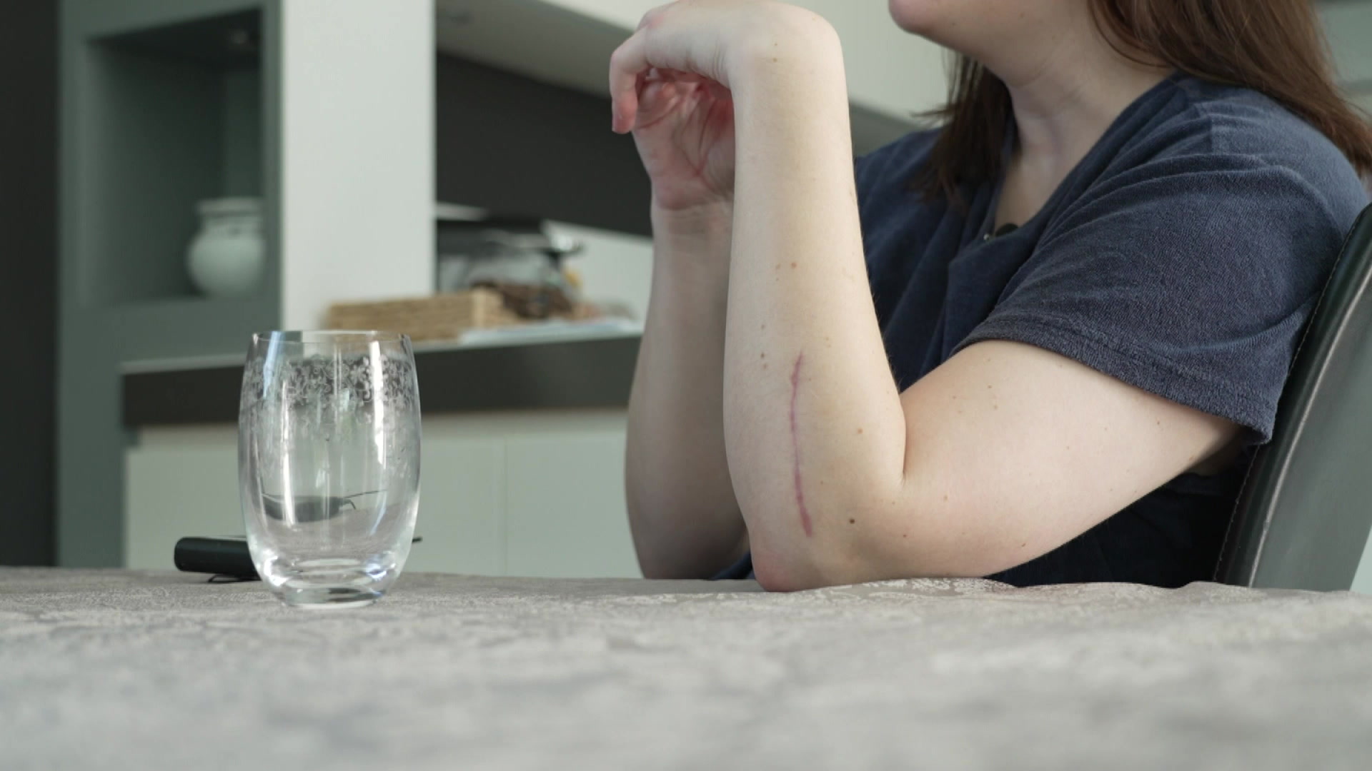 No Messerattack an Appartement um Lampertsbierg: “Ech probéieren, all Dag positiv opzestoen“